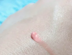 Biodermal Sun Lipbalm SPF25 - Tube 12 Ml - Natural Pink - Lippenbalsem -RHRQuality winkel 1200x927 2